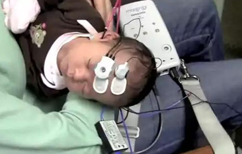 新生儿听力筛查认知