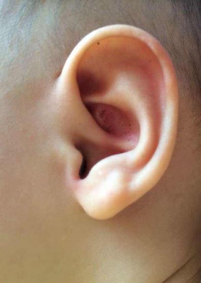 新生儿听力筛查仪是早期检测孩子听力障碍的方式