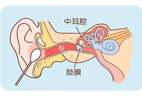 孩子耳朵进水怎么办？听力检查仪厂家给你支招！