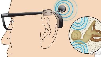 轻度听力障碍的孩子佩戴助听器会越戴越聋？