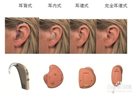 听力检查仪厂家介绍助听器的种类及儿童的适配类型