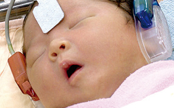 新生儿听力筛查把握黄金早疗期，让孩子听见幸福