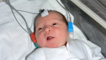 新生儿听力筛查常见问题
